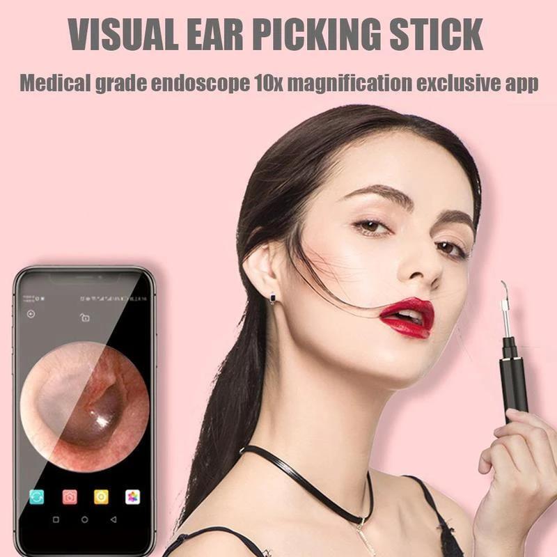 🔥LAST DAY-50%OFF🔥LocalityiTM Clean Earwax-Wi-Fi Visible Wax Removal Spoon, USB 1296P HD Load Otoscope