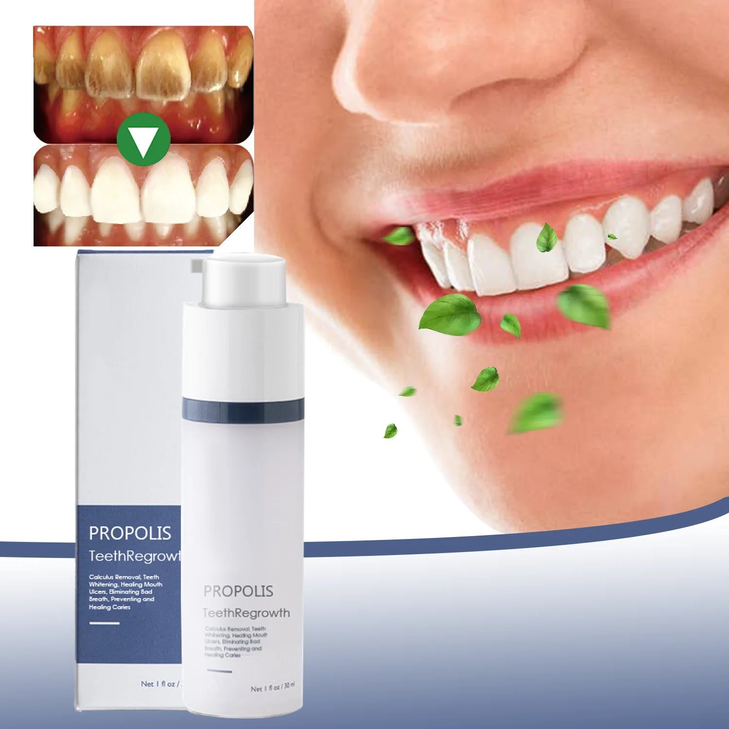 Propolis TeethRegrowth Dental Gel 2023 (For all kinds of oral problems, especially teeth regeneration)